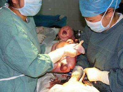 婦產科里的尷尬瞬間,這事一半以上的孕婦都難以啟齒_有人曾經調_寶寶樹